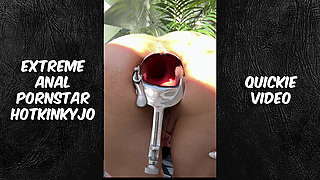 15.july.2025 Video Quickie Gape, Speculum, Anal Speculum, Anal, Hkj, Hotkinkyjo, Boobs, Ass, Asshole, Pornstar