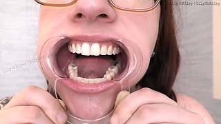 Sloppy Drooling Mouth Fetish W/cheek Spreader