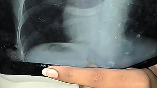 Tamil Doctor Hard Fuck with Boyfriend