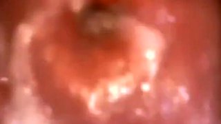 Play Speculum and View Inside My Pussy by Inside Camera