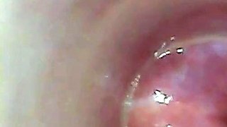 Endoscope POV: Test Tube Cock Urethral Insertion