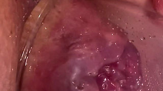 Extreme Anal Vacuum Pump Training 2025