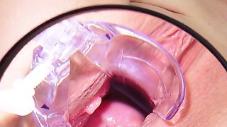 Doctor Fingers His Mature Patient to Orgasm During Her Gyno Exam