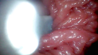 First Time: an Endoscope Reveals the G-spot up Close - Without Mounting!