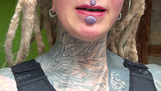 This Is Day 4 After My Boobs Surgery and My Body Is Healing