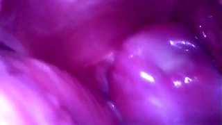 [amateur First Time Filming, Face Revealed] Akari (19) A -time Worker At A Family Restaurant In The Countryside. Internal Filming Of Her Vagina And Anus, And Creampie. Breast Teasing With A Sucking Device Inside. Anal Penetration Followed By Doggy Sty